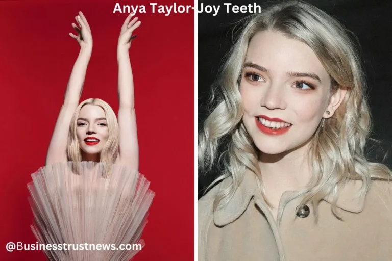 anya taylor-joy teeth