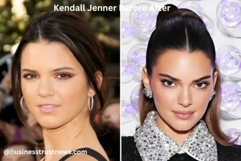 kendall jenner before after
